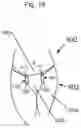 Fig. 16 - FASHION SCRUNCH CLIP APPARATUS AND METHOD