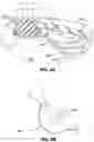 Fig. 06 - Pressure attenuating helmet