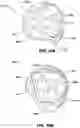 Fig. 11 - Pressure attenuating helmet