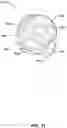 Fig. 12 - Pressure attenuating helmet
