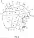 Fig. 03 - MULTILAYERED HELMET WITH INDEPENDENTLY MOVABLE SEGMENTS