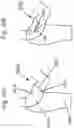 Fig. 15 - FASHION SCRUNCH CLIP APPARATUS AND METHOD