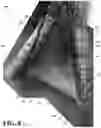 Fig. 09 - Modular firearm support, concealment aid, and shooting equipment holder assembly for a multi-legged stand