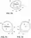 Fig. 10 - PEDICURE KIT PACKAGE SYSTEM