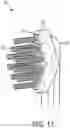 Fig. 11 - Brush head assembly and methods of manufacture