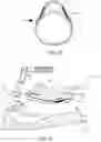 Fig. 09 - Retractor and tip extender therefor