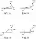 Fig. 10 - Retractor and tip extender therefor