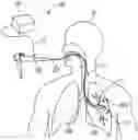 Fig. 01 - Airway visualization system