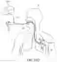Fig. 20 - Airway visualization system