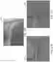 Fig. 26 - Airway visualization system
