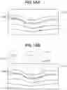 Fig. 15 - TOMOGRAPHIC IMAGE ACQUISITION APPARATUS AND TOMOGRAPHIC IMAGE ACQUISITION METHOD