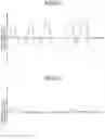 Fig. 13 - Visual function detection apparatus, method of detecting visual function, and program