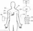 Fig. 01 - IMPLANTABLE RECHARGEABLE TELEMETRY DEVICE