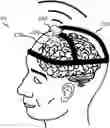 Fig. 01 - Wireless neural interface system