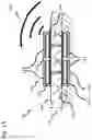 Fig. 03 - Wireless neural interface system