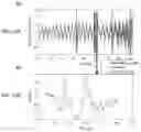 Fig. 17 - Methods for extracting subject motion from multi-transmit electrical coupling in imaging of the subject