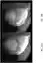 Fig. 22 - Methods for extracting subject motion from multi-transmit electrical coupling in imaging of the subject