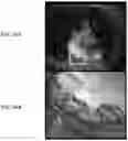 Fig. 35 - Methods for extracting subject motion from multi-transmit electrical coupling in imaging of the subject