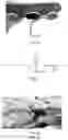Fig. 02 - Tissue elasticity measurement