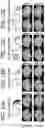 Fig. 13 - SUPER-PIXEL DETECTION FOR WEARABLE DIFFUSE OPTICAL TOMOGRAPHY