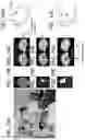 Fig. 15 - SUPER-PIXEL DETECTION FOR WEARABLE DIFFUSE OPTICAL TOMOGRAPHY