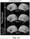 Fig. 16 - SUPER-PIXEL DETECTION FOR WEARABLE DIFFUSE OPTICAL TOMOGRAPHY