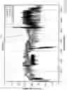 Fig. 21 - System and method for measuring pressure waves in dialysis lines