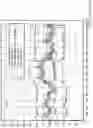 Fig. 30 - System and method for measuring pressure waves in dialysis lines