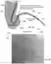 Fig. 05 - Hemodynamic analysis system