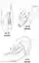 Fig. 02 - Physiological monitoring devices having sensing elements decoupled from body motion
