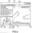 Fig. 09 - Real-time automatic registration feedback