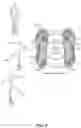 Fig. 06 - Foot-mounted sensor systems for tracking body movement