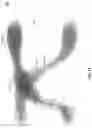 Fig. 09 - Assessing diseases by analyzing gait measurements
