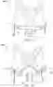 Fig. 18 - ADAPTIVE SUPPORT APPAREL SYSTEMS AND METHODS