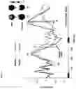 Fig. 03 - COMPUTER-IMPLEMENTED METHOD AND APPARATUS FOR DETECTING AND PREDICTING THE NEURAL SIGNATURE OF DISORDERS OF EXECUTIVE FUNCTIONS