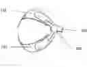 Fig. 01 - System and method for maintaining sensor contact