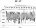 Fig. 15 - Method, apparatus and computer program for measuring and analysis of blood pressure using photoplethysmography