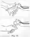 Fig. 15 - Articulating patient positioning apparatus