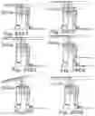 Fig. 35 - Articulating patient positioning apparatus