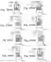 Fig. 40 - Articulating patient positioning apparatus