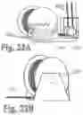 Fig. 52 - Articulating patient positioning apparatus