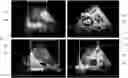 Fig. 01 - Techniques for determining ultrasound probe motion