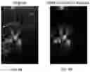 Fig. 05 - Kalman filtering for flash artifact suppression in ultrasound imaging