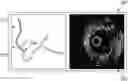 Fig. 01 - CO-REGISTRATION SYSTEMS AND METHODS FO RENHANCING THE QUALITY OF INTRAVASCULAR IMAGES