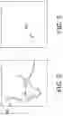 Fig. 03 - CO-REGISTRATION SYSTEMS AND METHODS FO RENHANCING THE QUALITY OF INTRAVASCULAR IMAGES