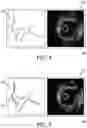 Fig. 04 - CO-REGISTRATION SYSTEMS AND METHODS FO RENHANCING THE QUALITY OF INTRAVASCULAR IMAGES