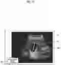 Fig. 17 - Acoustic wave diagnostic apparatus and control method of acoustic wave diagnostic apparatus