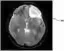 Fig. 01 - Biopsy device for coherent Raman imaging