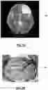 Fig. 02 - Biopsy device for coherent Raman imaging