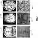 Fig. 05 - Biopsy device for coherent Raman imaging